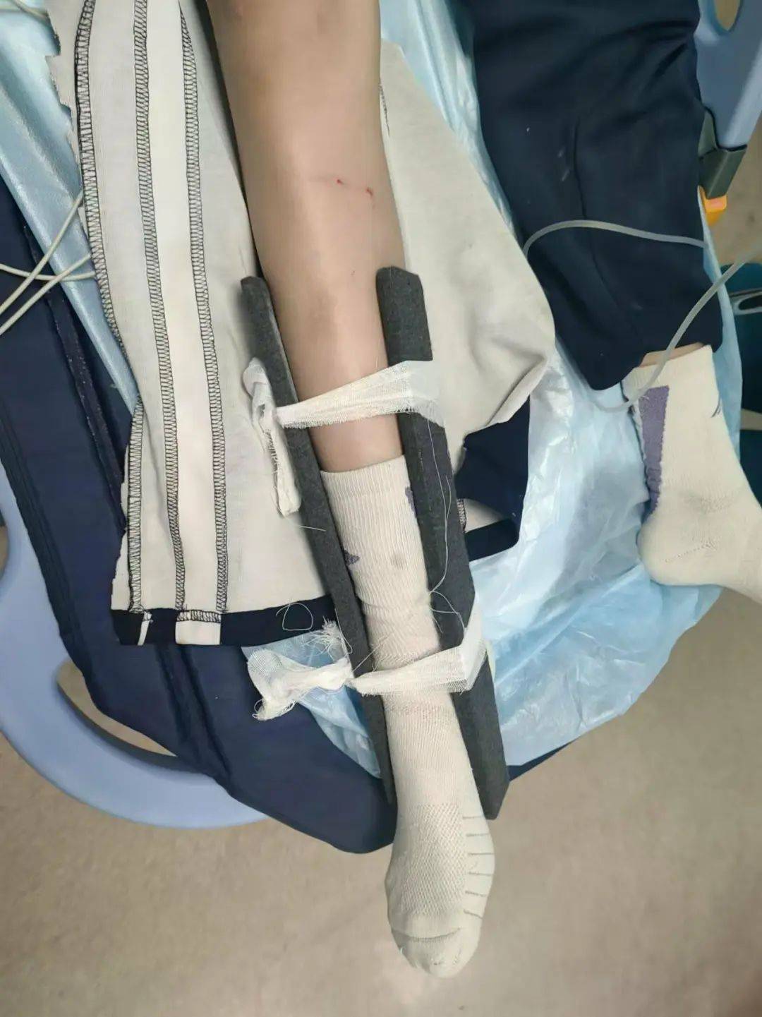 皇冠信用網要押金吗 _惨痛皇冠信用網要押金吗 !一人身亡!深圳多名学生骑电动车发生意外