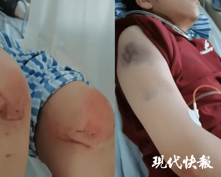 皇冠信用盘在哪里开通
_石家庄被家暴女子驾车逃跑致丈夫身亡皇冠信用盘在哪里开通
,一审以故意杀人罪获刑11年