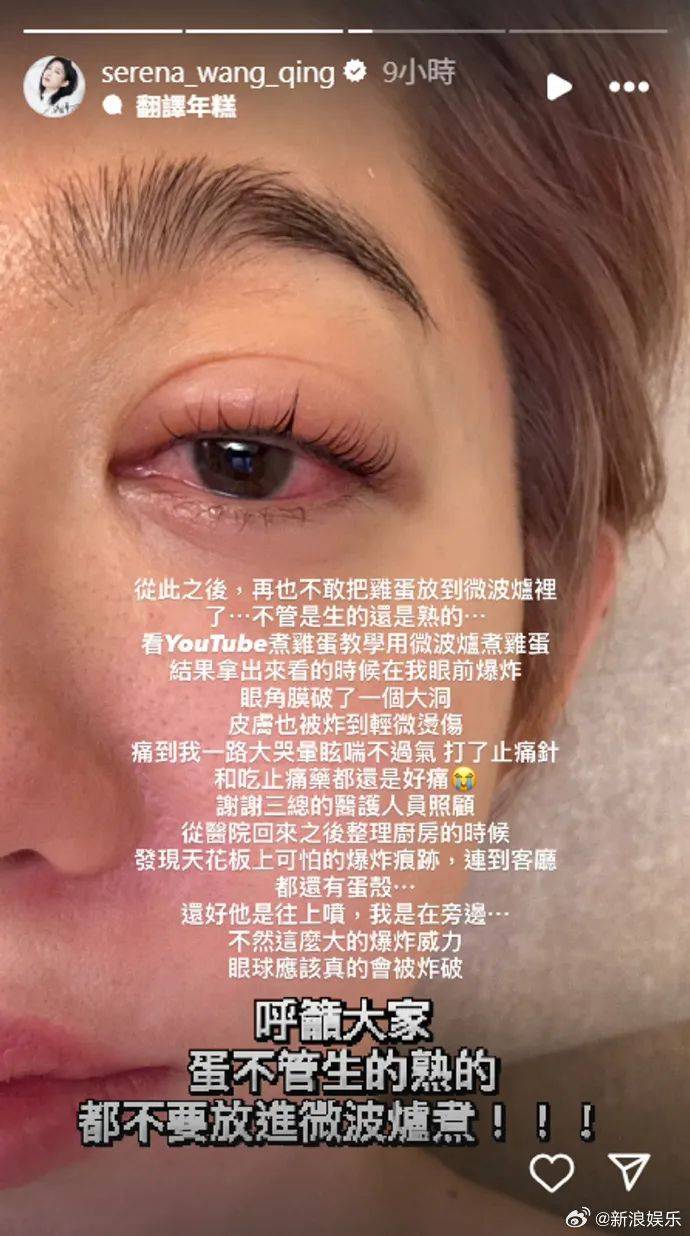 皇冠信用網在哪里开通_突然爆炸皇冠信用網在哪里开通!知名女演员自曝:痛到大哭眩晕