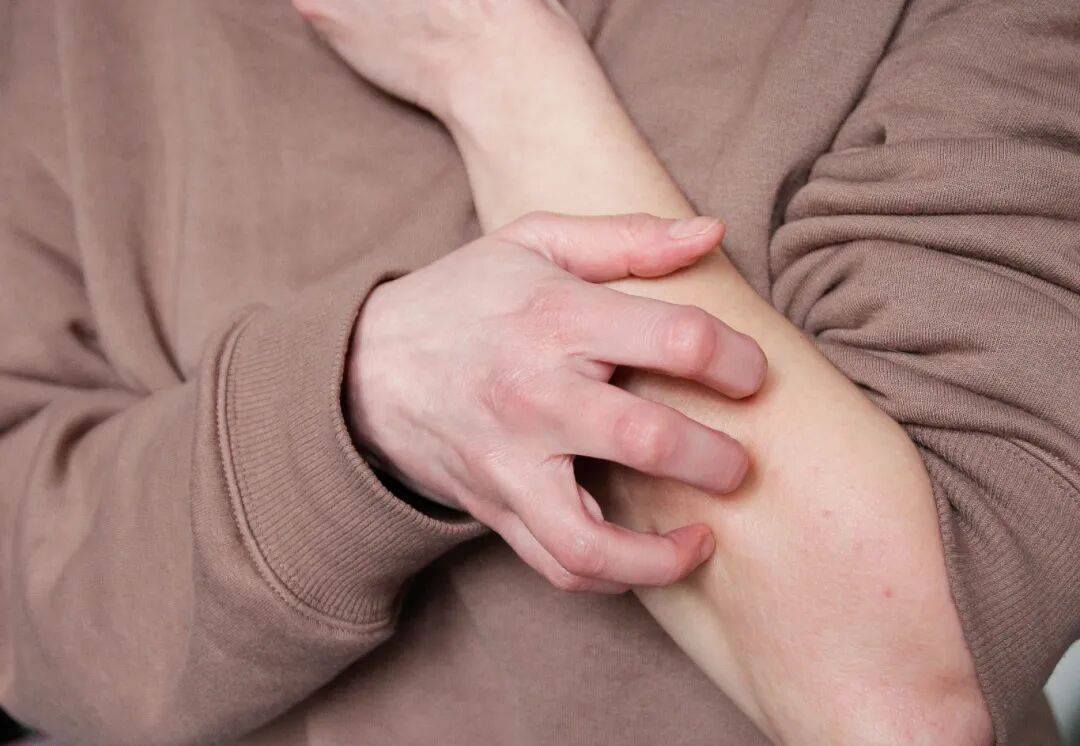 皇冠信用網是什么意思_事发上海街头!女子突然浑身肿胀皇冠信用網是什么意思,陷入昏迷...医生:建议随身携带肾上腺激素笔