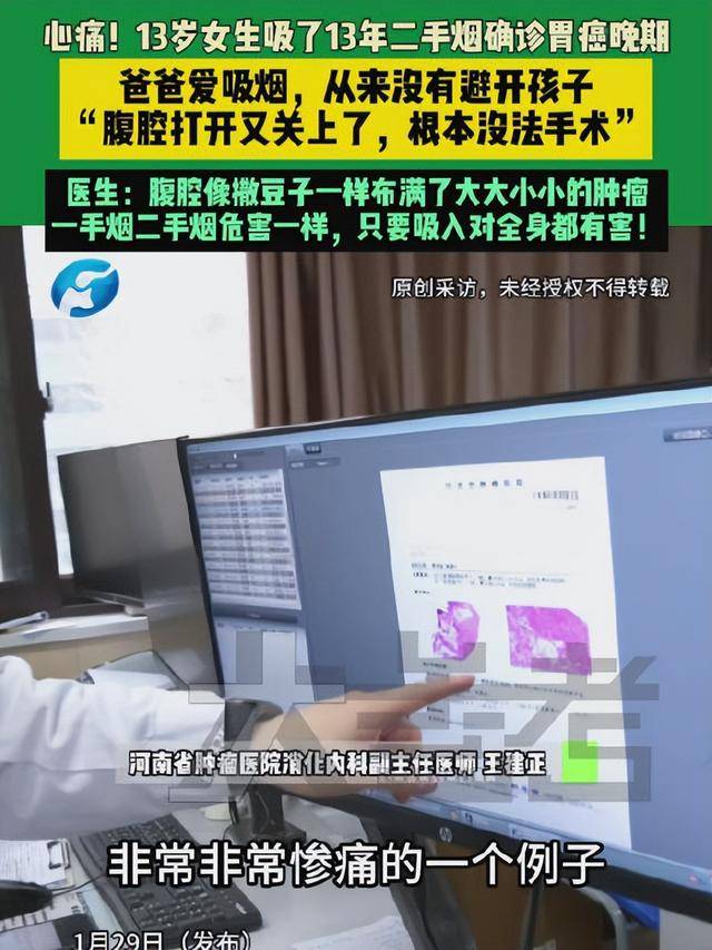 皇冠信用网登0_爸爸常年在家吸烟皇冠信用网登0,13岁女儿吸13年二手烟腹腔内长满肿瘤