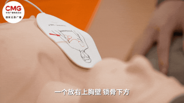 皇冠信用盘网址
_山东一市民突发心梗皇冠信用盘网址
,其家属砸窗取出陌生人车内AED用于急救;车主回应:砸就砸吧,人命比玻璃重要