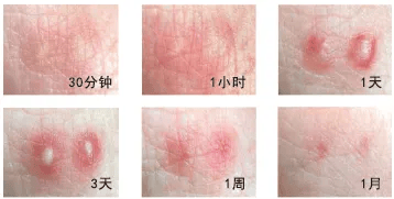 皇冠信用网如何申请_“五一假期”外出看见这种小土包皇冠信用网如何申请,千万别踩!